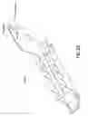Fig. 28 - Rotational, translational and torqueing control members for an endoscopic instrument