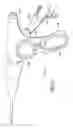 Fig. 33 - Rotational, translational and torqueing control members for an endoscopic instrument