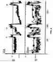 Fig. 05 - Methods and devices for determining brain state