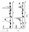 Fig. 07 - Methods and devices for determining brain state