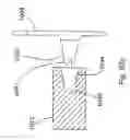 Fig. 49 - Spine distraction implant and method