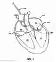 Fig. 02 - Devices and methods for anchoring tissue
