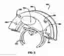Fig. 08 - Devices and methods for anchoring tissue