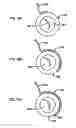 Fig. 22 - Devices and methods for anchoring tissue
