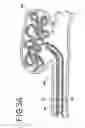 Fig. 06 - Stretch resistant embolic coil delivery system with mechanical release mechanism