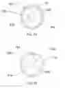 Fig. 08 - Method and apparatus for percutaneous wound sealing