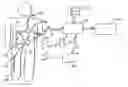 Fig. 01 - Wireless Communication Network for an Implantable Medical Device System