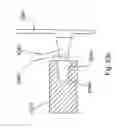 Fig. 49 - Spine distraction implant and method