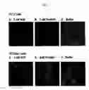 Fig. 08 - Stable mutated pro nerve growth factors