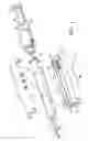 Fig. 02 - Biopsy device with aperture orientation and improved tip