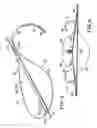 Fig. 03 - Apparatus and method for developing an anatomic space for laparoscopic hernia repair and patch for use therewith