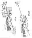 Fig. 05 - Apparatus and method for developing an anatomic space for laparoscopic hernia repair and patch for use therewith
