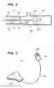 Fig. 09 - Apparatus and methods for sealing a vascular puncture