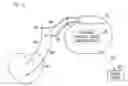 Fig. 01 - Method and apparatus for neural stimulation with respiratory feedback