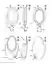 Fig. 04 - LIGHTED DENTAL CLEANER