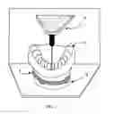 Fig. 02 - METHODS FOR THE VIRTUAL DESIGN AND COMPUTER MANUFACTURE OF INTRA ORAL DEVICES