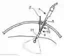 Fig. 01 - Puncture adapter and an ultrasonic probe, and the method of using the same