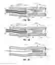 Fig. 06 - Systems, Methods, and Devices to Facilitate Wire and Device Crossings of Obstructions in Body Lumens