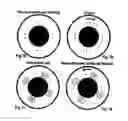 Fig. 07 - Methods for treating eye conditions