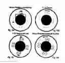 Fig. 10 - Methods for treating eye conditions