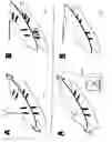 Fig. 12 - Methods for treating eye conditions