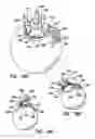Fig. 16 - Methods for treating eye conditions