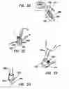 Fig. 17 - Methods for treating eye conditions