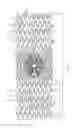 Fig. 02 - Bifurcated Stent