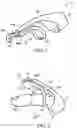 Fig. 02 - FINGER-MOUNTED SUTURE CUTTER