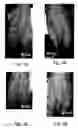 Fig. 02 - Prostaglandin compositions and methods for the treatment of vasospasm