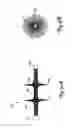 Fig. 06 - Method and device for filtering body fluid