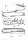 Fig. 03 - Therapeutic footwear and method of using same