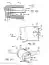 Fig. 12 - Cold collapse method and apparatus