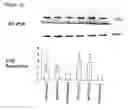 Fig. 02 - Transient receptor potential channel TRPM8 and its use