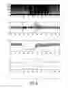 Fig. 07 - Method and Aparatus for Presenting Information Concerning Flow Behavior of a Bodyfluid Externally Measured by Ultrasound