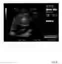 Fig. 07 - System and method for utilizing shape analysis to assess fetal abnormality