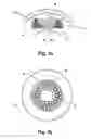 Fig. 04 - Ophthalmological apparatus for the refractive correction of an eye