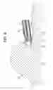 Fig. 09 - High Frequency Incision Tool For Endoscope
