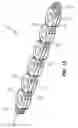 Fig. 06 - Flexible bone fixation device
