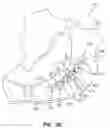 Fig. 19 - Flexible bone fixation device