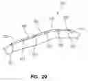 Fig. 20 - Flexible bone fixation device