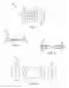 Fig. 02 - Cervical dynamic stabilization system