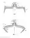 Fig. 02 - Self-opening skin staple