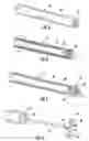 Fig. 06 - System and method of bone compression and fixation