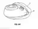 Fig. 07 - INSERTION APPARATUS HAVING A CONCAVE SURFACE