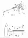 Fig. 02 - Arthroscopic soft tissue plication systems and methods