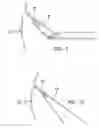 Fig. 06 - Arthroscopic soft tissue plication systems and methods
