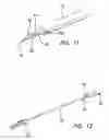 Fig. 07 - Arthroscopic soft tissue plication systems and methods