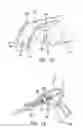 Fig. 08 - Arthroscopic soft tissue plication systems and methods