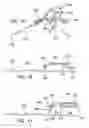 Fig. 09 - Arthroscopic soft tissue plication systems and methods